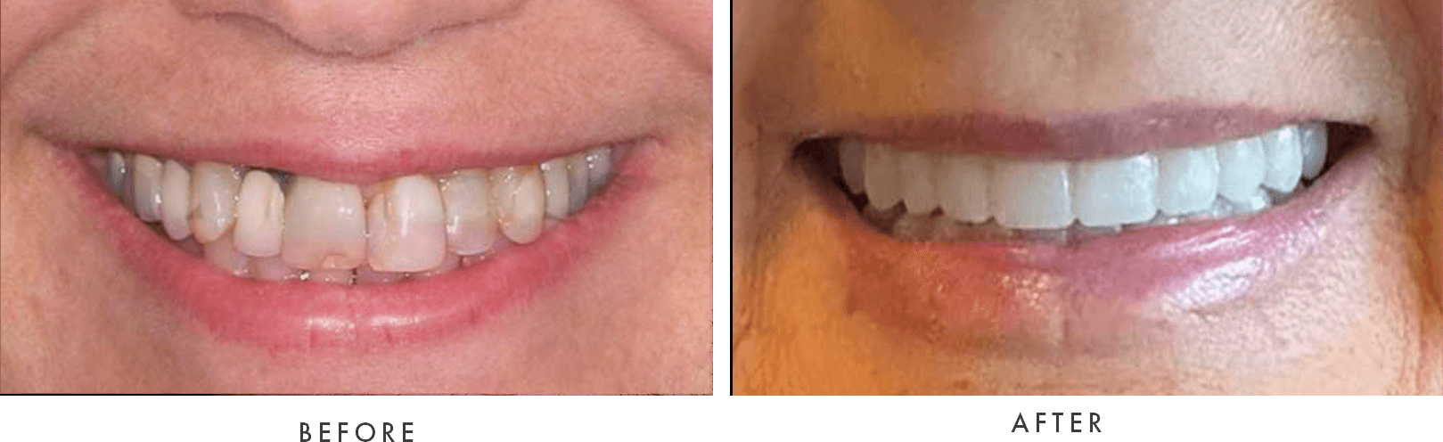 close up of before and after images of patient