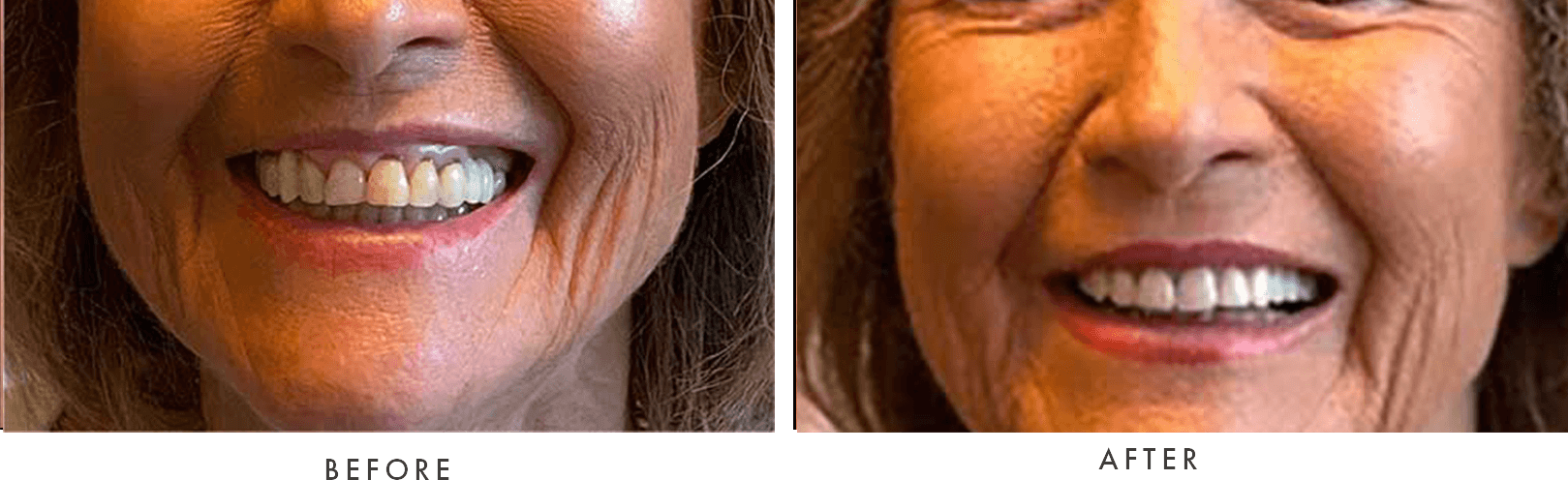 close up of before and after images of patient