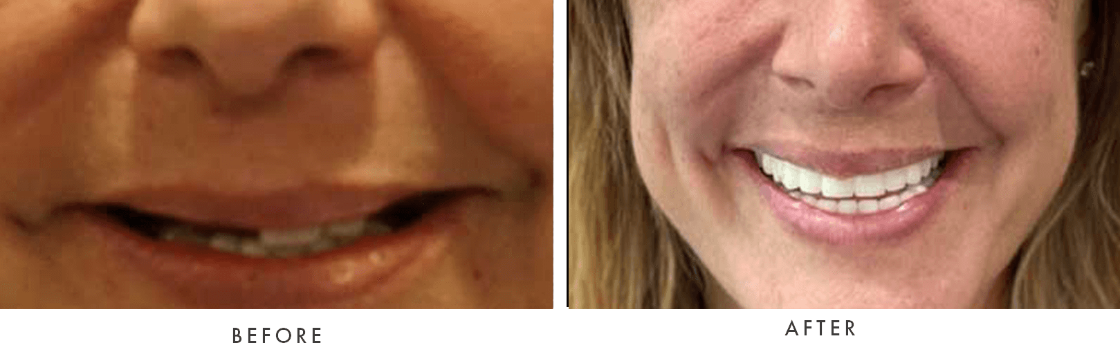 close up of before and after images of patient