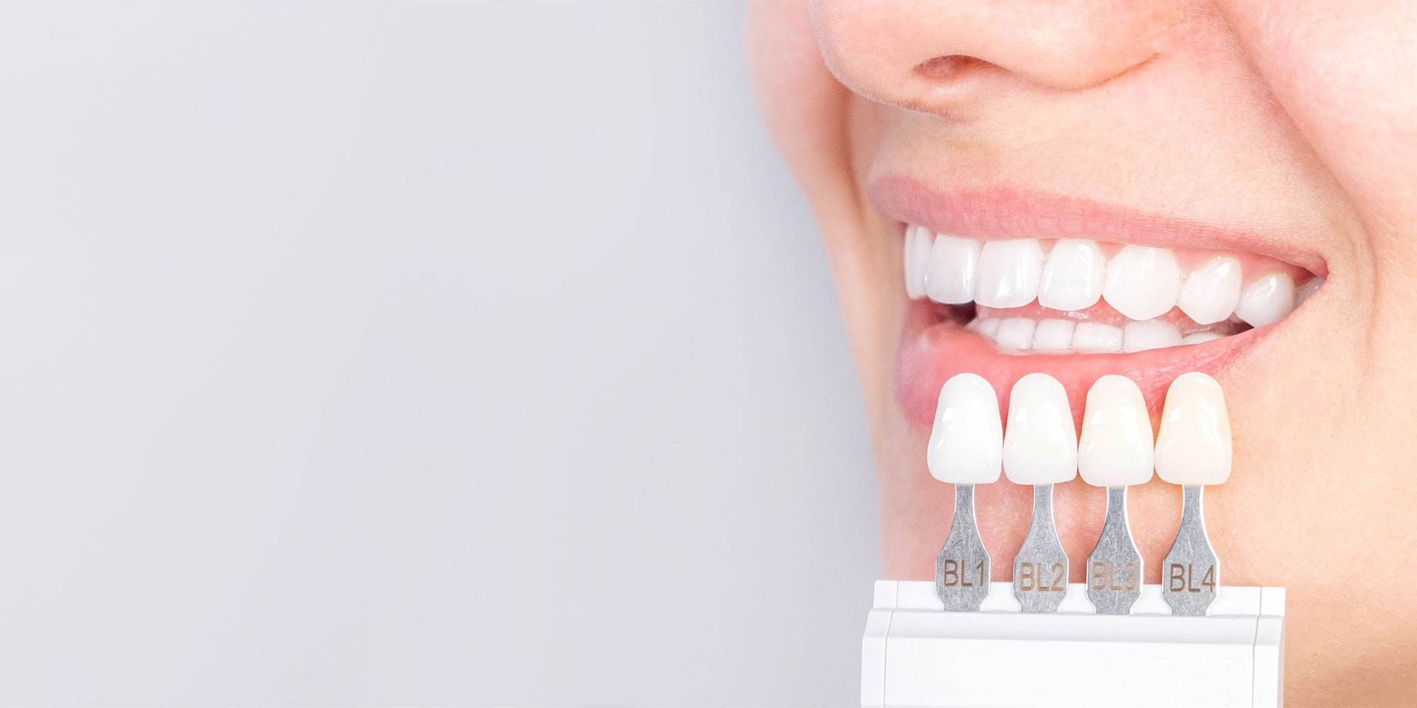 close up of veneers models