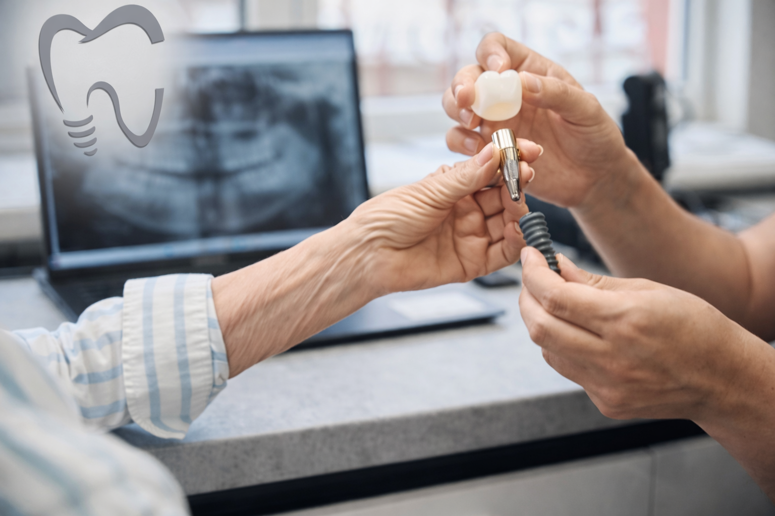 The Right Candidate for Full Mouth Dental Implants in Kearny